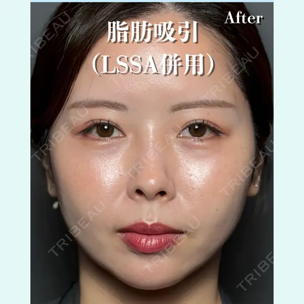 RÉ CLINIQUE SENDAI 田中 龍二医師の症例