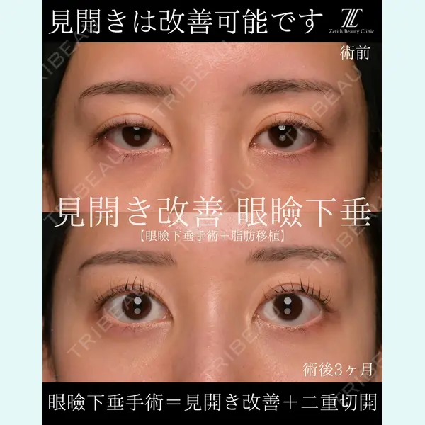 Zetith Beauty Clinic 大阪心斎橋院 楠本 拓哉医師の症例