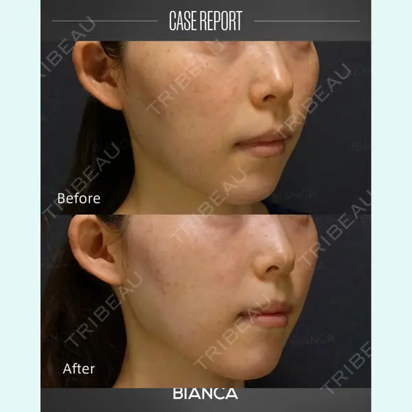 BIANCA銀座 葉山 愛弥医師の症例