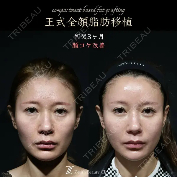 Zetith Beauty Clinic 新宿院 王 蘇医師の症例