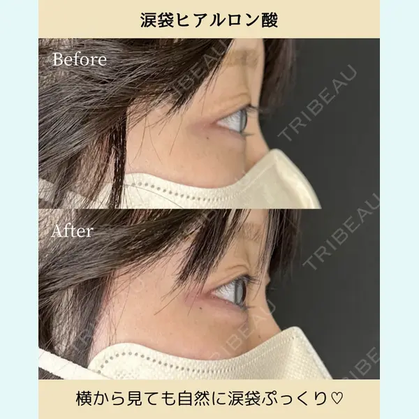 ルラ美容クリニック 静岡院 成田 央良医師の症例