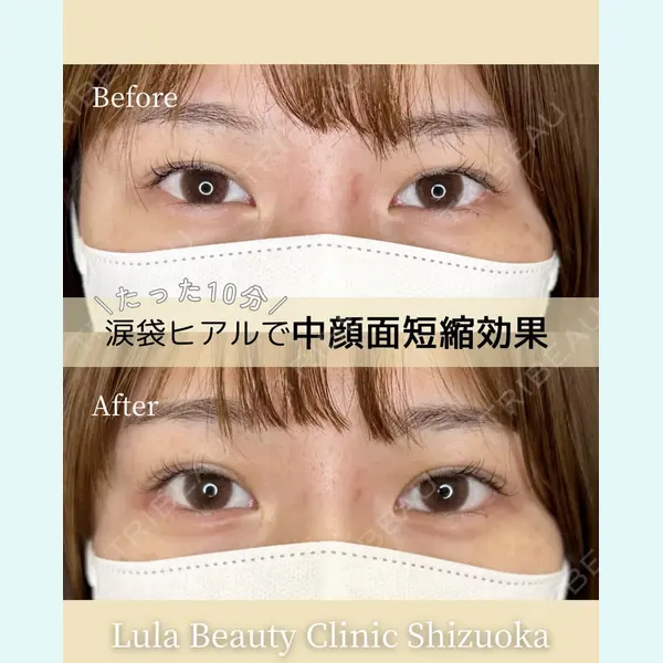 ルラ美容クリニック 静岡院 成田 央良医師の症例