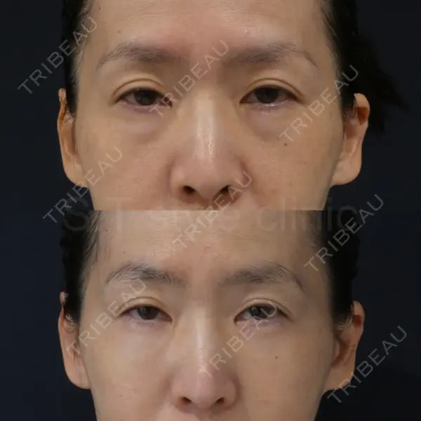 S.T styleクリニック 徳田 真紀子医師の症例