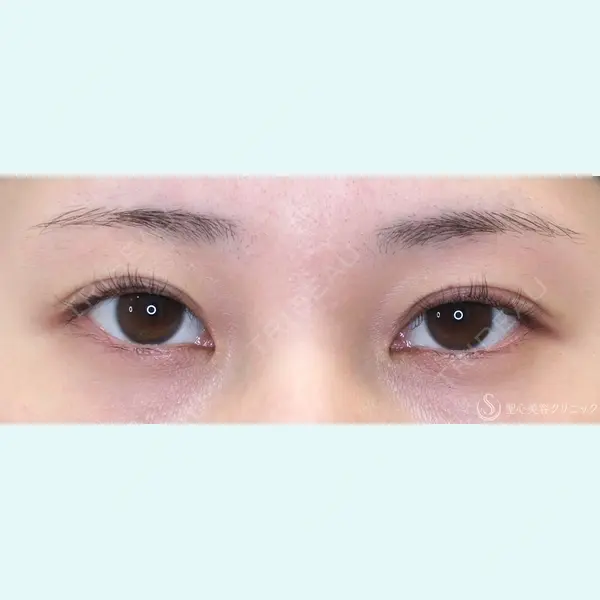 聖心美容クリニック 福岡院 美原 寿之医師の症例