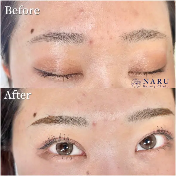 NARU Beauty Clinic 【ナルクリ】の症例