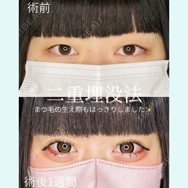 ルラ美容クリニック 仙台院 / ルラスキンクリニック 仙台院 橋本 英樹医師の症例