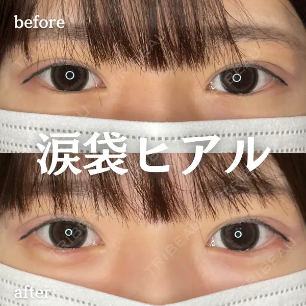 ルラ美容クリニック 新宿院 陶 美梨医師の症例