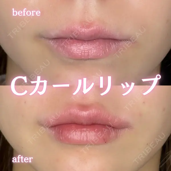 ルラ美容クリニック 新宿院 陶 美梨医師の症例