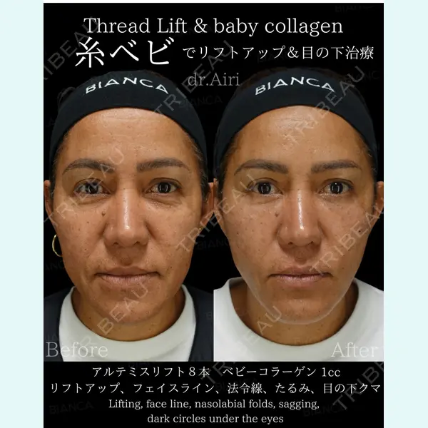 BIANCA銀座 横山 歩依里医師の症例