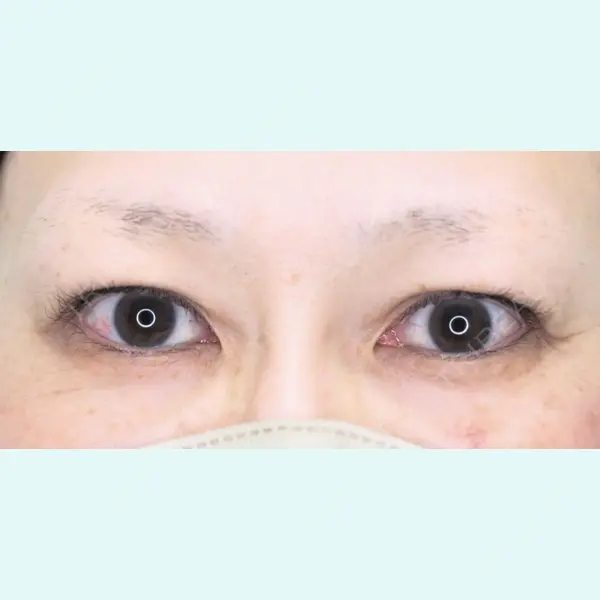 広島本通り美容クリニックの症例