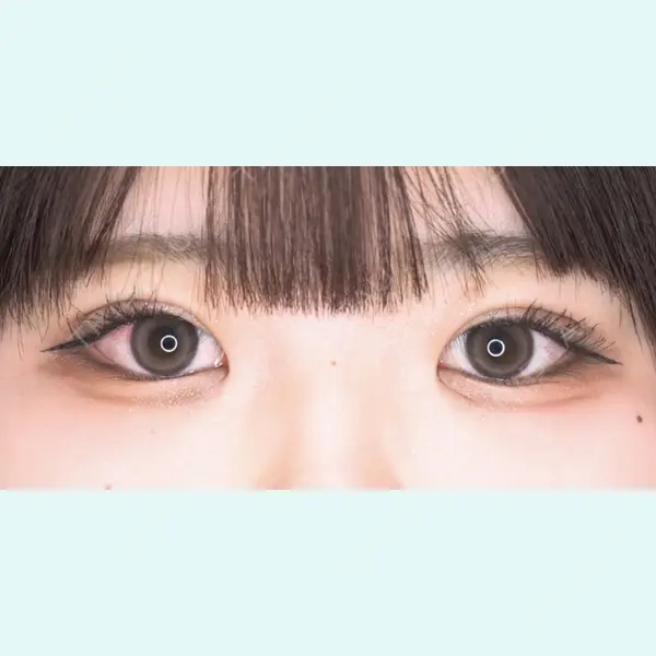 広島本通り美容クリニック 松尾 林太郎医師の症例