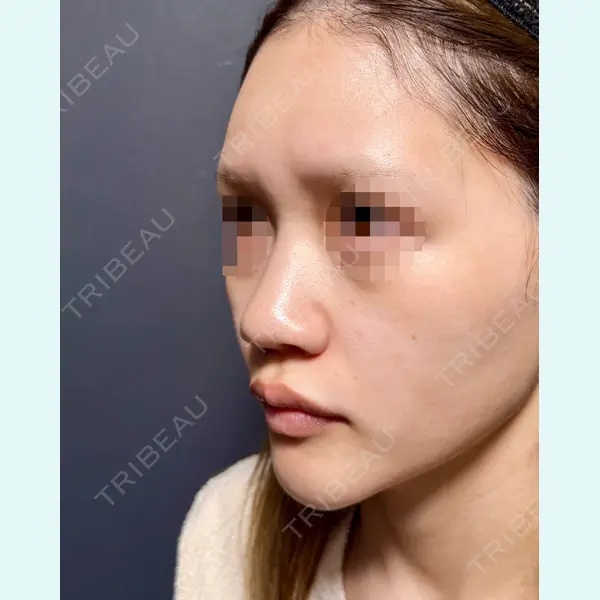 表参道ウィズ・クリニック 太田 恵介医師の症例