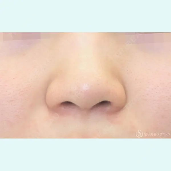 聖心美容クリニック 福岡院 美原 寿之医師の症例