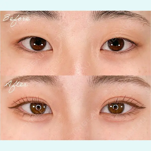 TCB東京中央美容外科 池袋駅前院 岡本 卓也医師の症例