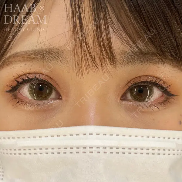HAAB×DREAM BEAUTY CLINIC 東京本院 田中 優太医師の症例
