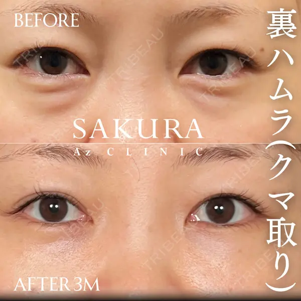 サクラアズクリニック 心斎橋院 佐藤 博文医師の症例