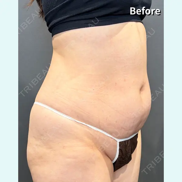 RÉ CLINIQUE SENDAI 田中 龍二医師の症例