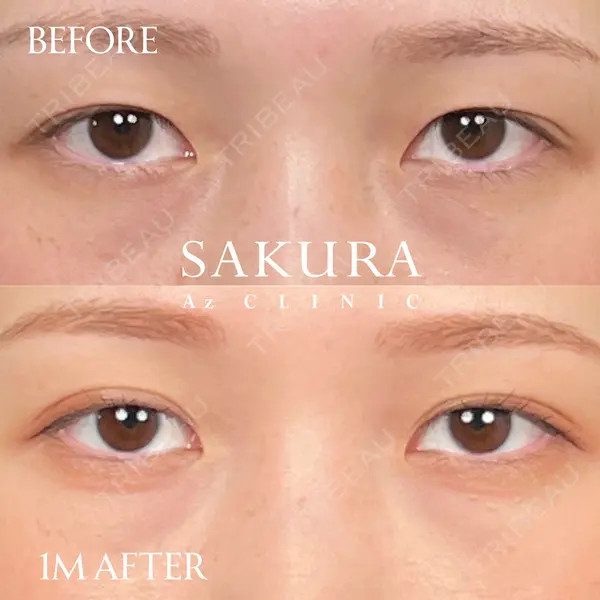 サクラアズクリニック 心斎橋院 佐藤 博文医師の症例