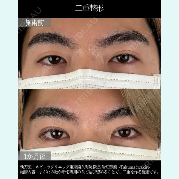 ネビュラクリニック 東京錦糸町院 岩切 琢磨医師の症例