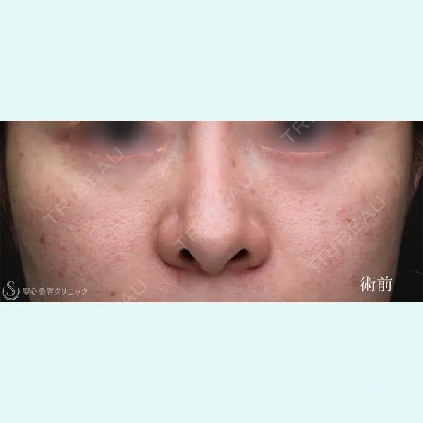 聖心美容クリニック 銀座院 川端 優也医師の症例