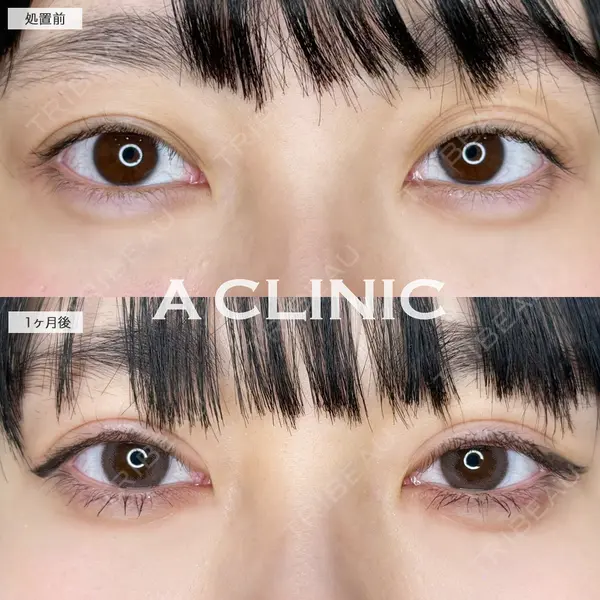 A CLINIC（エークリニック） 仙台院 伊藤 瑠桂医師の症例