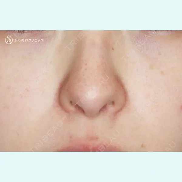 聖心美容クリニック 札幌院 前多 一彦医師の症例