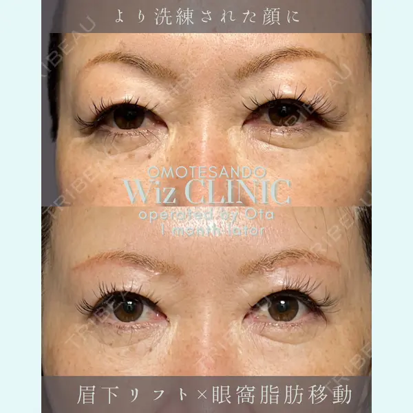 表参道ウィズ・クリニック 太田 恵介医師の症例