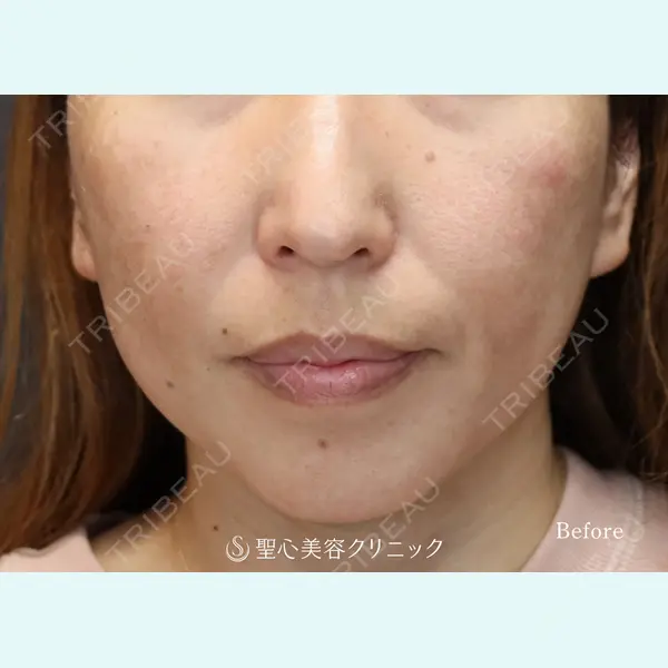 聖心美容クリニック 大阪院 大井 弘一医師の症例