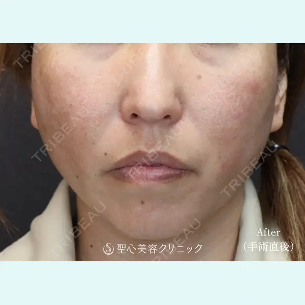 聖心美容クリニック 大阪院 大井 弘一医師の症例