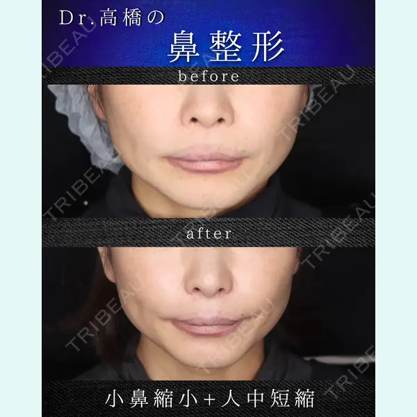 吉祥寺アイビークリニック 高橋 京佑 医師の症例