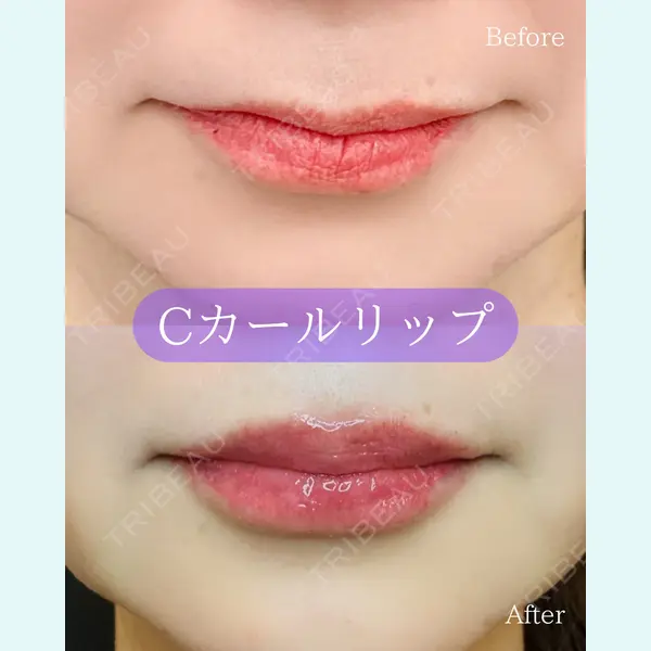 ルラ美容クリニック 郡山院の症例