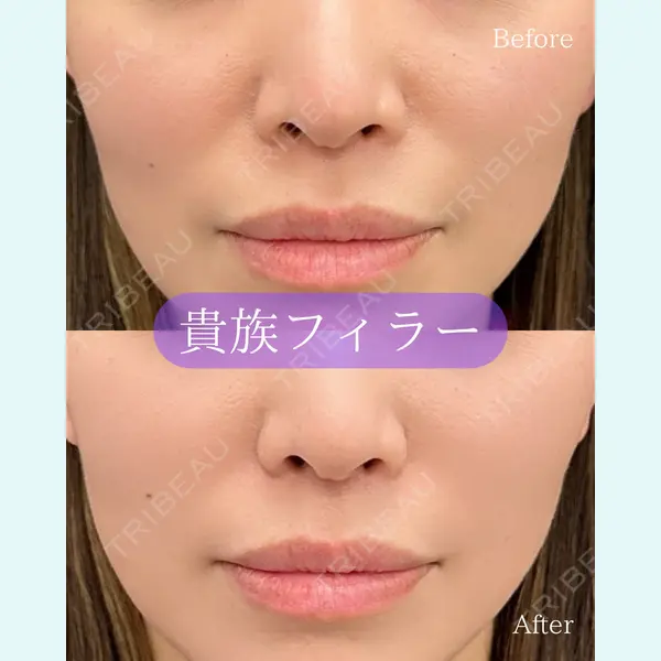 ルラ美容クリニック 郡山院の症例