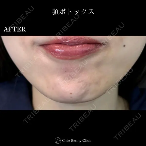Code Beauty Clinic 名古屋院 橋本 祥平医師の症例