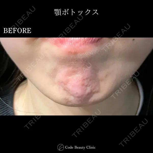 Code Beauty Clinic 名古屋院 橋本 祥平医師の症例