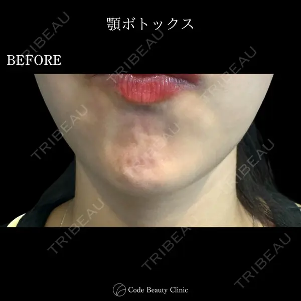 Code Beauty Clinic 名古屋院 橋本 祥平医師の症例