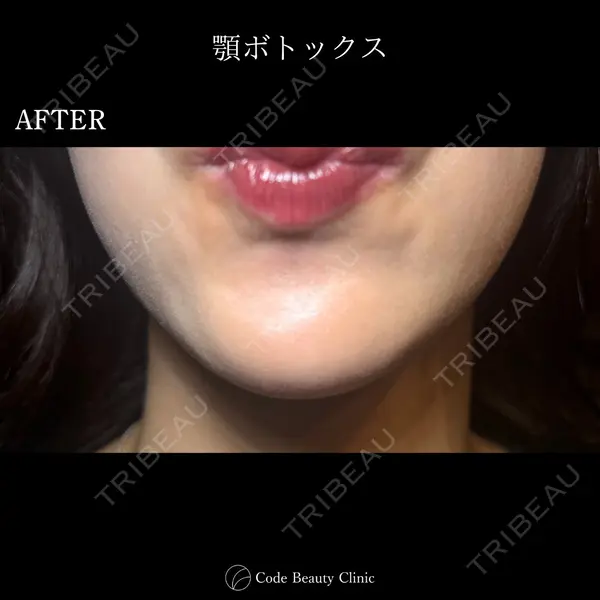 Code Beauty Clinic 名古屋院 橋本 祥平医師の症例