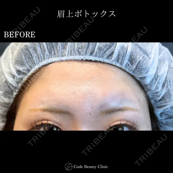 Code Beauty Clinic 名古屋院 橋本 祥平医師の症例