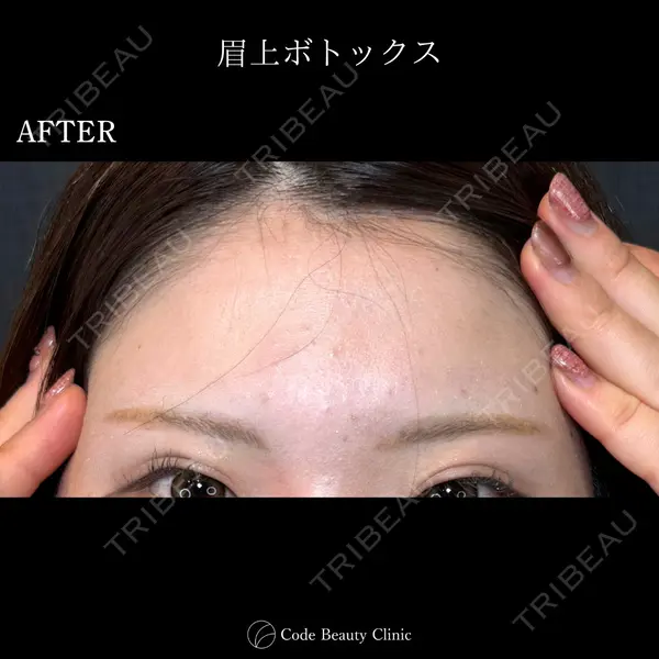 Code Beauty Clinic 名古屋院 橋本 祥平医師の症例