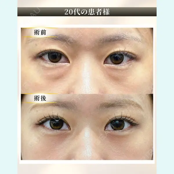 ルラ美容クリニック 札幌本院 早坂 亮哉医師の症例