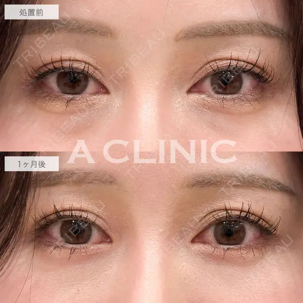 A CLINIC（エークリニック） 福岡院 高平 青洋医師の症例