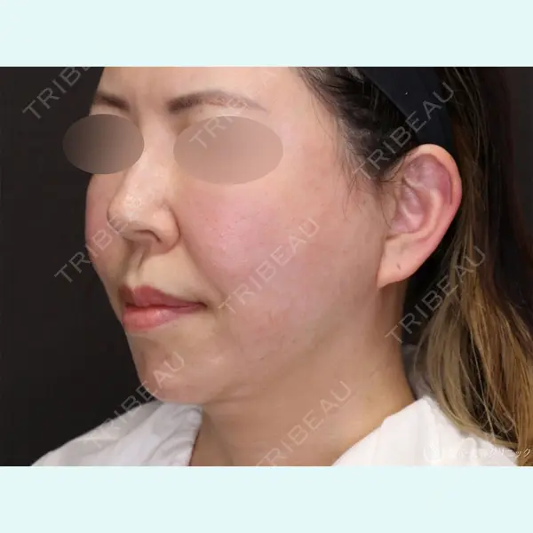 聖心美容クリニック 大阪院 寺町 英明医師の症例