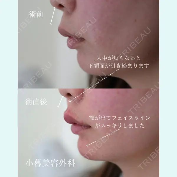 小暮整形外科・美容外科の症例