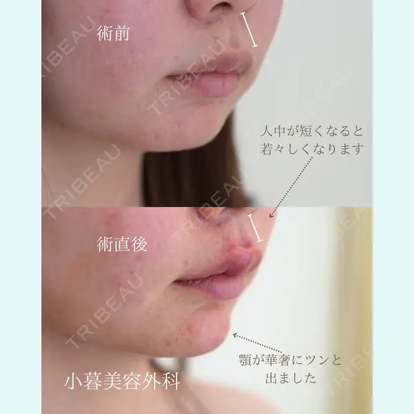 小暮整形外科・美容外科の症例