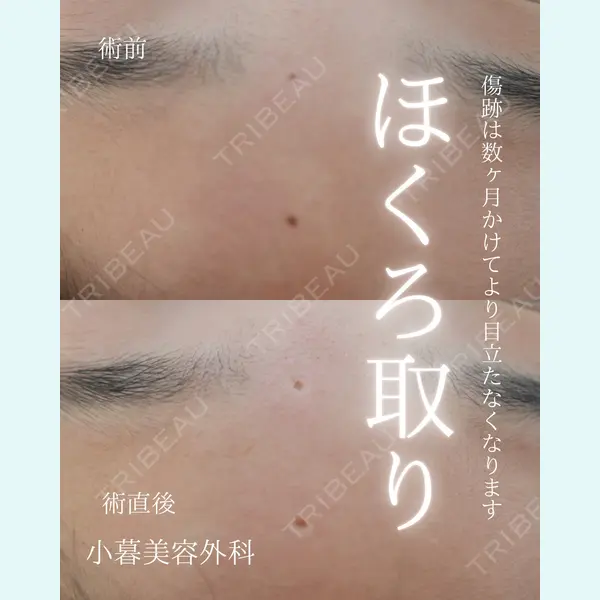 小暮整形外科・美容外科の症例