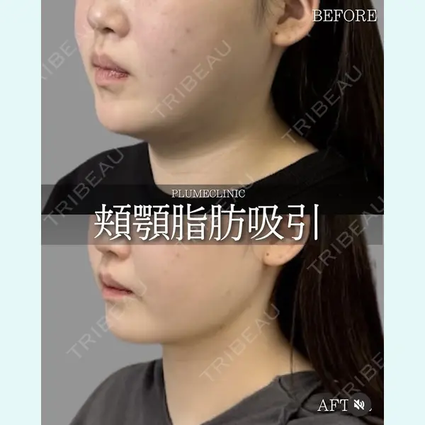 plume clinic 向山 綾子医師の症例