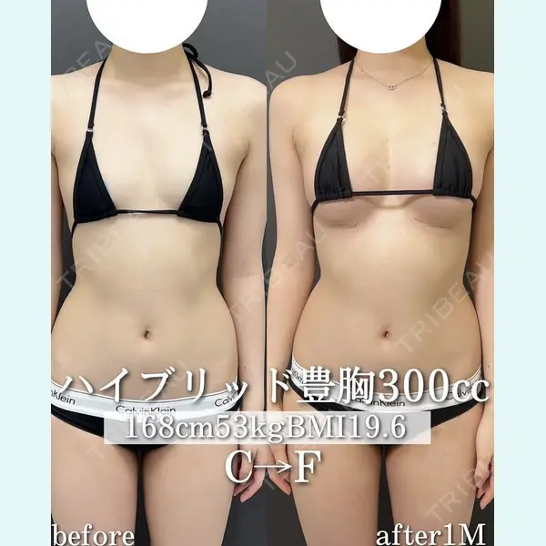 plume clinic 向山 綾子医師の症例