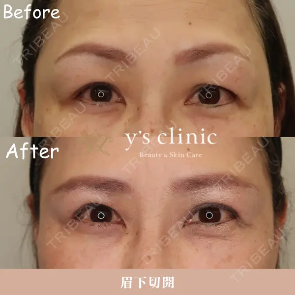 y's clinicの症例