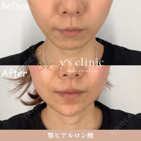 y's clinicの症例