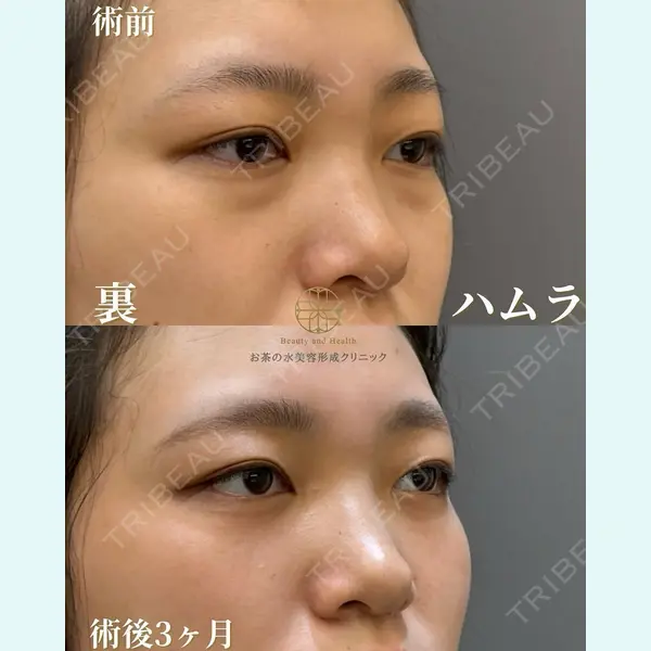 お茶の水美容形成クリニック 吉井 健吾医師の症例