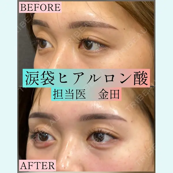 ルラ美容クリニック 横浜院 金田 成美医師の症例